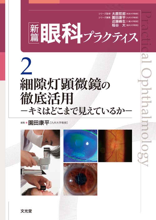 細隙灯顕微鏡の徹底活用