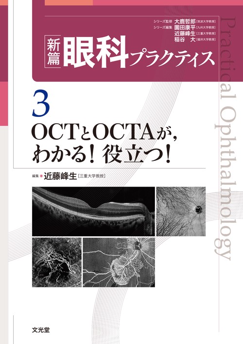 OCTとOCTAが，わかる！役立つ！