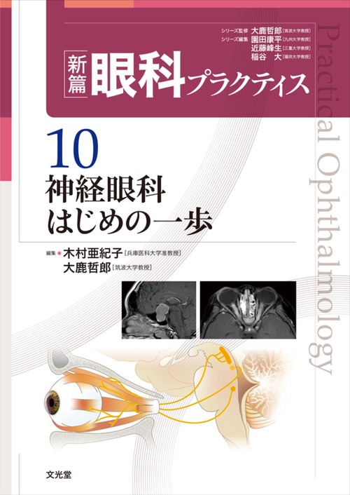 神経眼科はじめの一歩　(新篇眼科プラクティス 10)