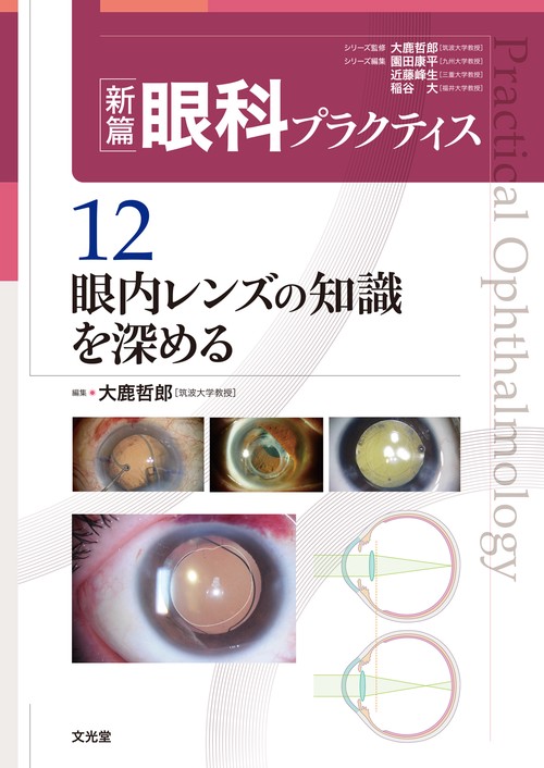 眼内レンズの知識を深める　(新篇眼科プラクティス 12)