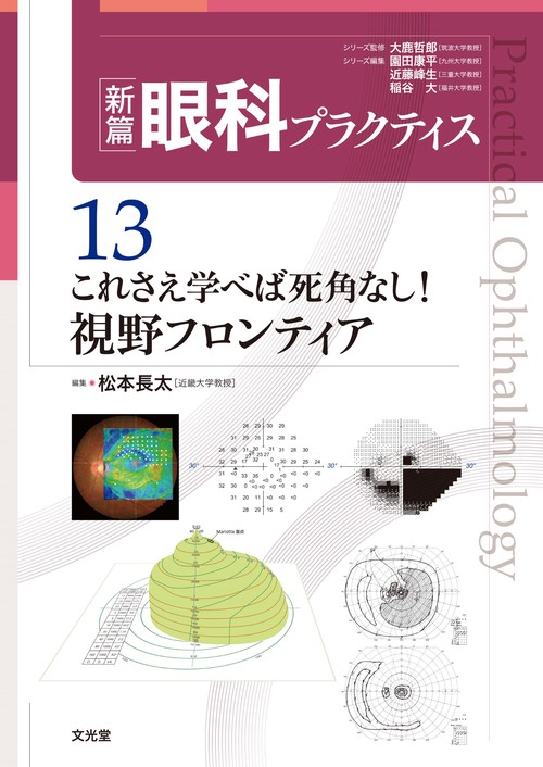 これさえ学べば死角なし！視野フロンティア　(新篇眼科プラクティス 13)
