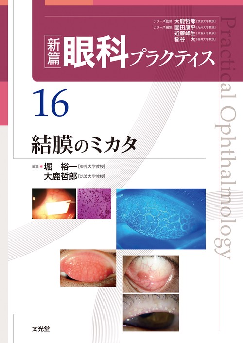 結膜のミカタ　(新篇眼科プラクティス 16)
