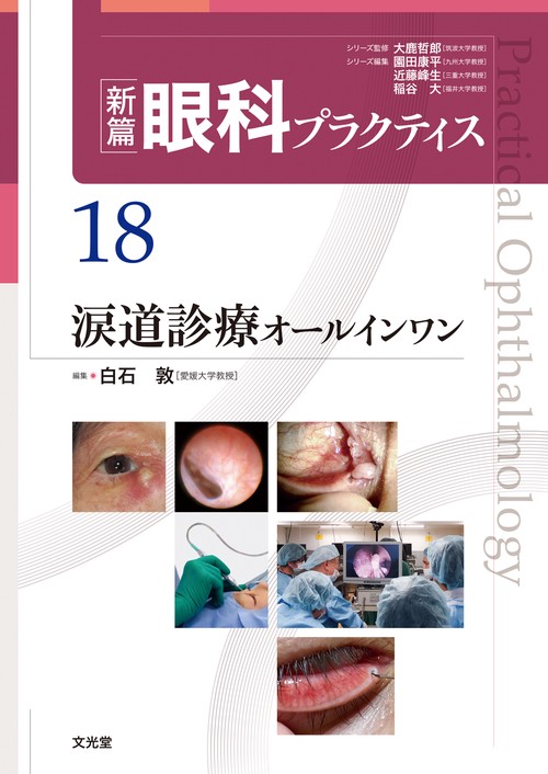 涙道診療オールインワン　(新篇眼科プラクティス 18)