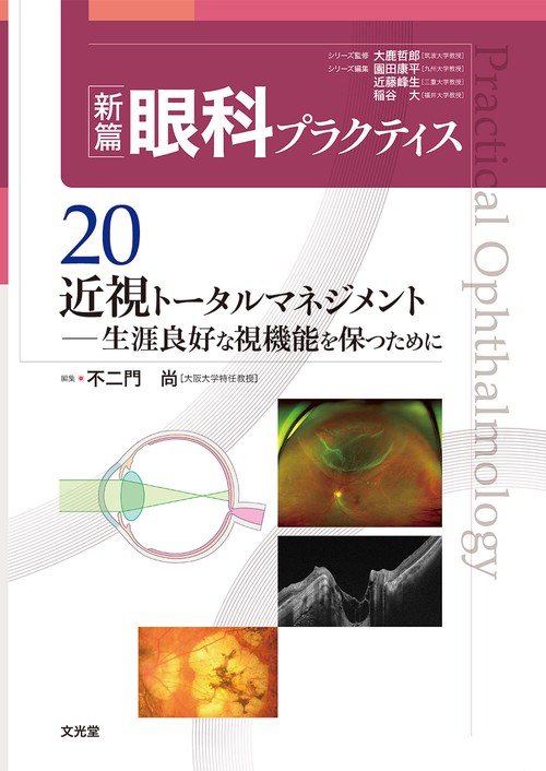 近視トータルマネジメント　(新篇眼科プラクティス 20)