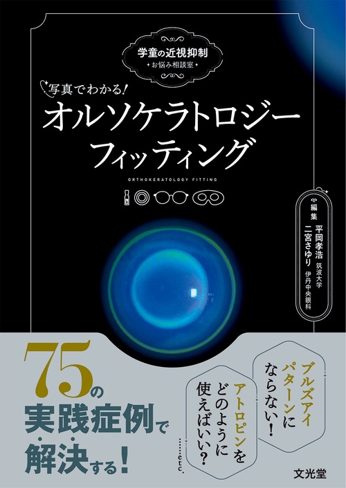 写真でわかる！オルソケラトロジーフィッティング 学童の近視抑制 お