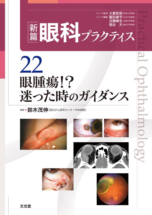 眼腫瘍！？迷った時のガイダンス　(新篇眼科プラクティス 22)