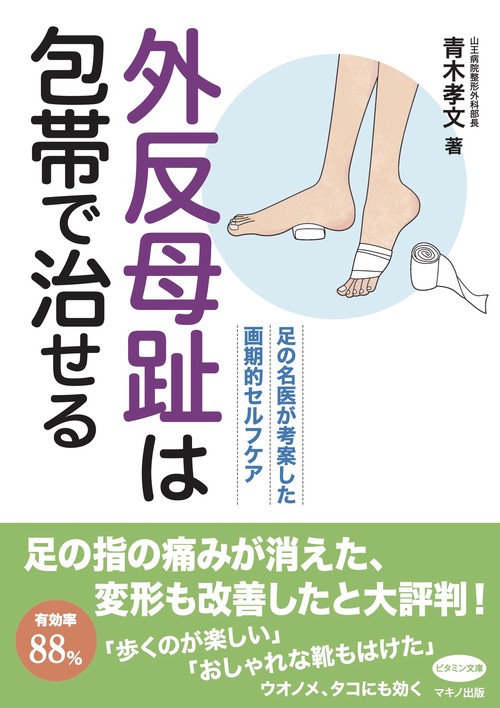 外反母趾は包帯で治せる