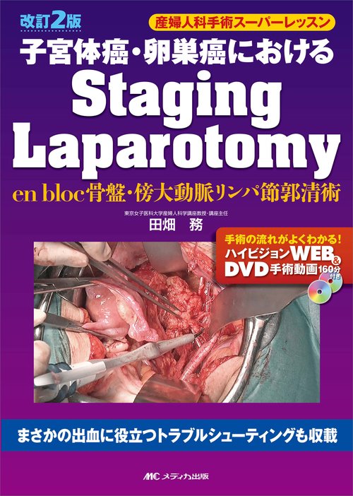 改訂２版　子宮体癌・卵巣癌におけるStaging Laparotomy
