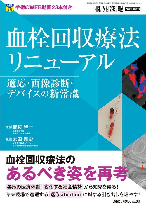 血栓回収療法リニューアル
