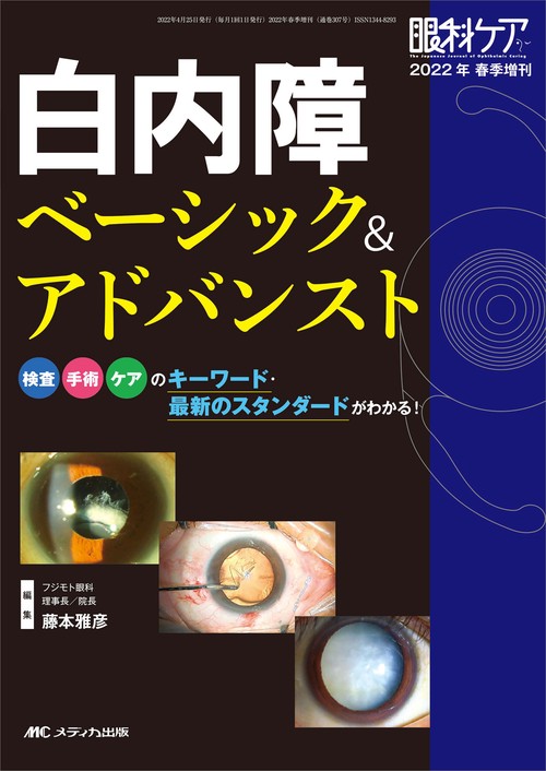 白内障 ベーシック＆アドバンスト