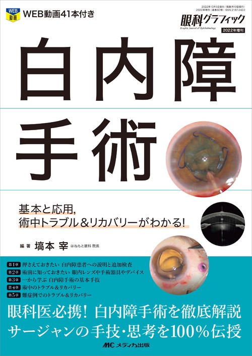 白内障手術
