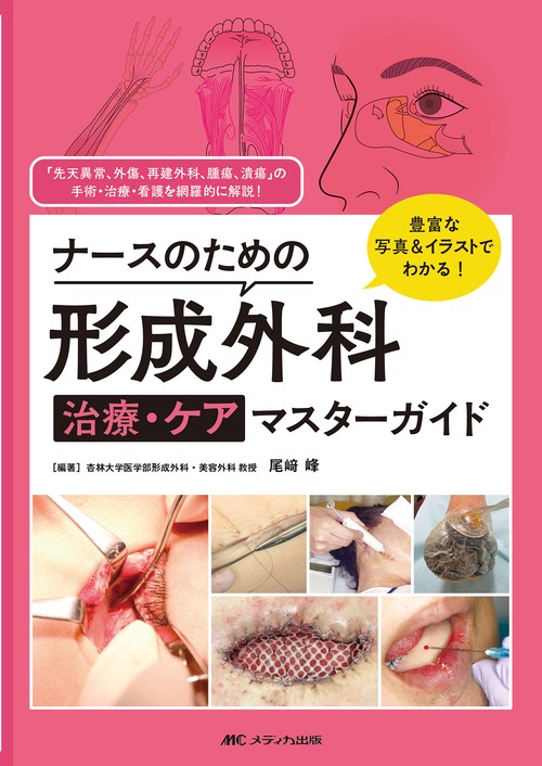 ナースのための形成外科 治療・ケアマスターガイド