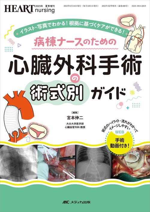 病棟ナースのための 心臓外科手術の術式別ガイド