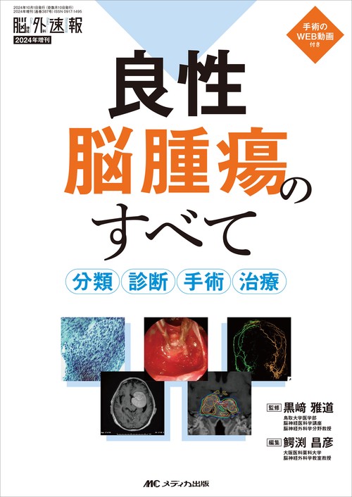良性脳腫瘍のすべて