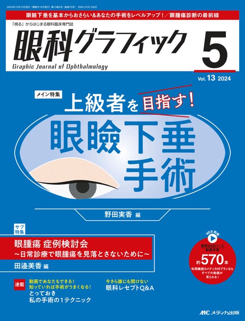 眼科グラフィック2024年5号