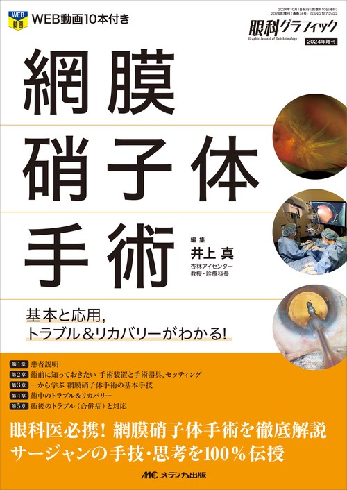 網膜硝子体手術