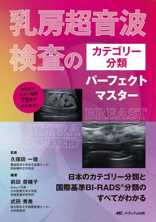 乳房超音波検査のカテゴリー分類パーフェクトマスター