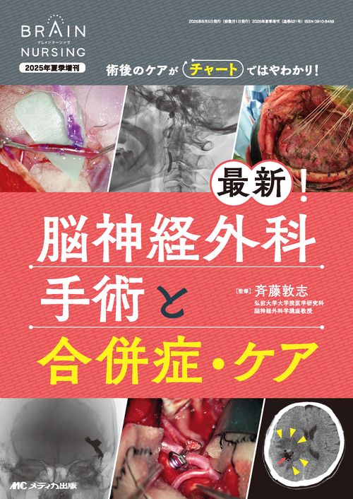 最新！脳神経外科手術と合併症・ケア