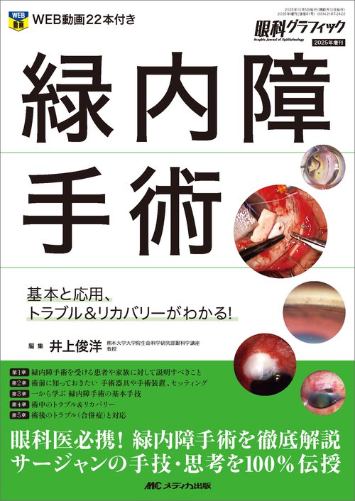 緑内障手術