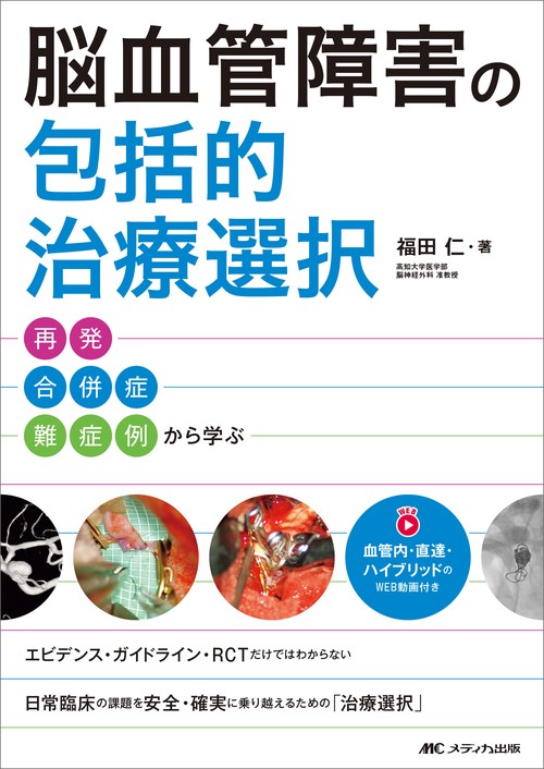 脳血管障害の包括的治療選択　再発・合併症・難症例から学ぶ