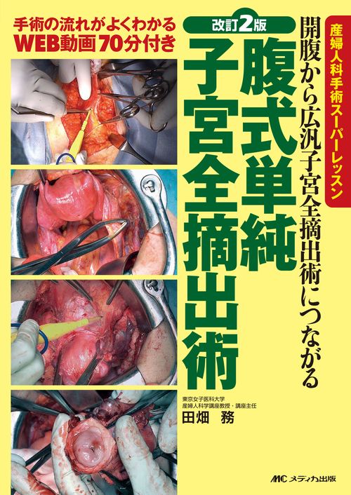 改訂2版　腹式単純子宮全摘出術