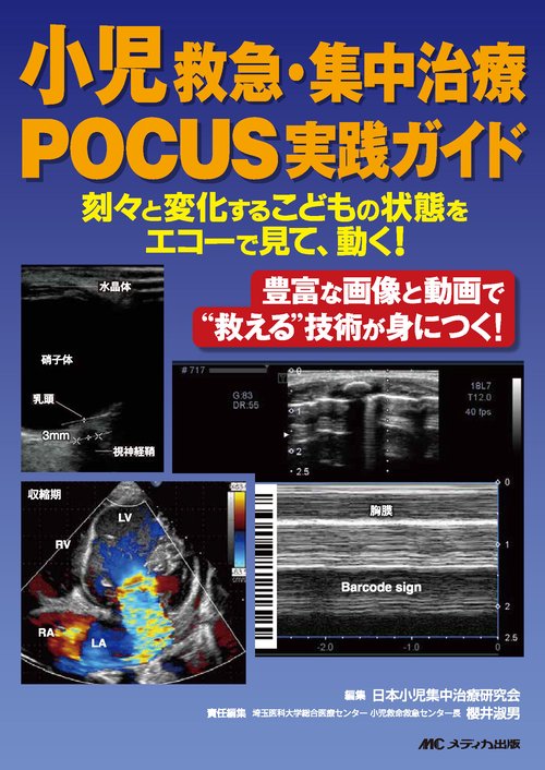 小児救急・集中治療POCUS実践ガイド
