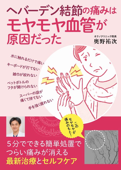 ヘバーデン結節の痛みはモヤモヤ血管が原因だった