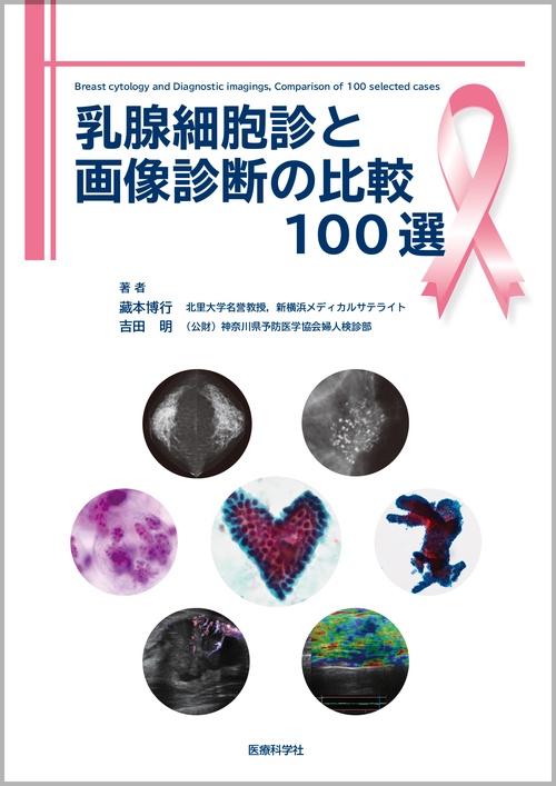 乳腺細胞診と画像診断の比較100選