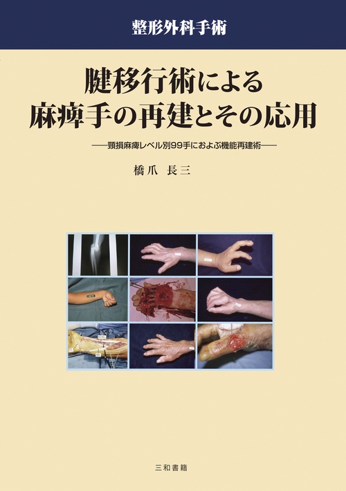 腱移行術による麻痺手の再建とその応用