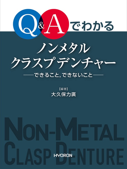 Q&Aでわかるノンメタルクラスプデンチャー できること,できないこと