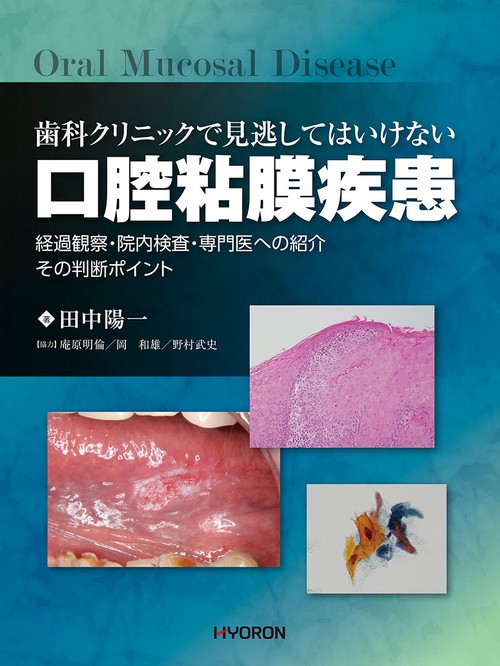 歯科クリニックで見逃してはいけない　口腔粘膜疾患