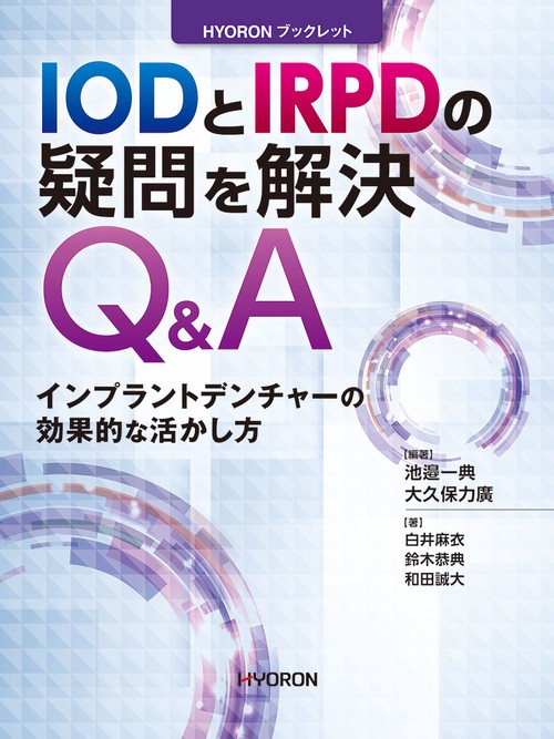 IODとIRPDの疑問を解決Q&A