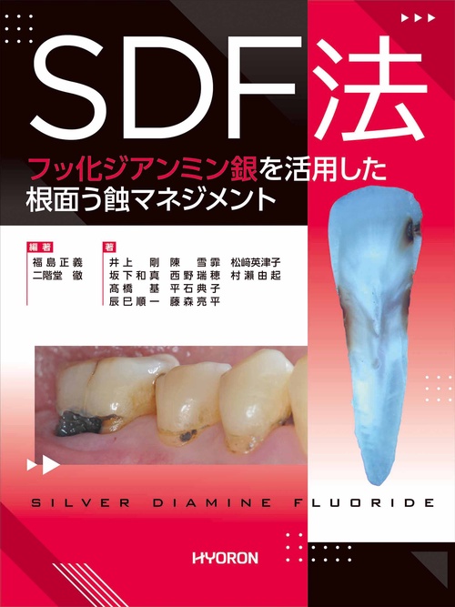 SDF法