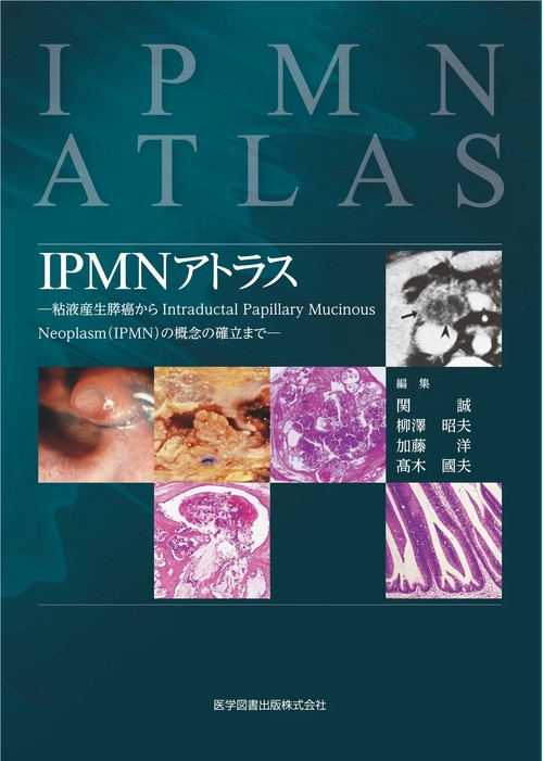 IPMNアトラス 粘液産生膵癌からIntraductal Papillary Mucinous Neoplasm〈IPMN〉の概念の確立まで