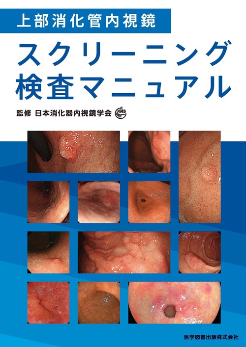 上部消化管内視鏡スクリーニング検査マニュアル