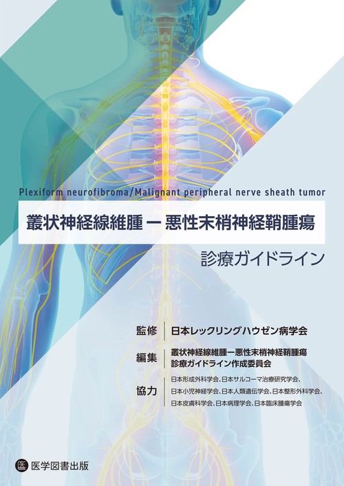 叢状神経線維腫悪性末梢神経鞘