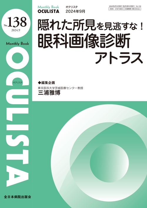 隠れた所見を見逃すな！眼科画像診断アトラス