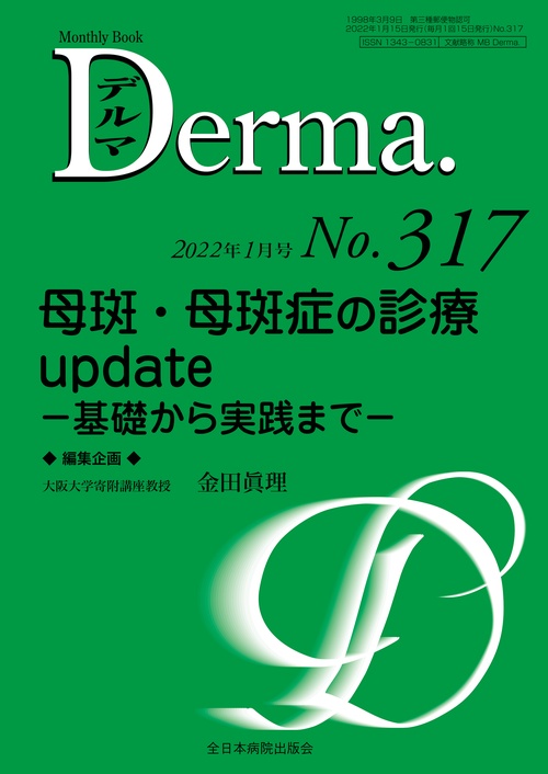 母斑・母斑症の診療update