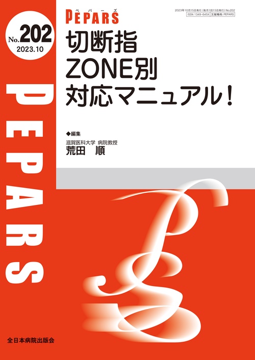 切断指　ZONE別対応マニュアル！