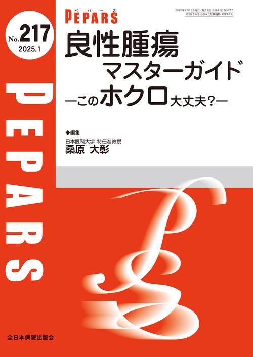 良性腫瘍マスターガイド