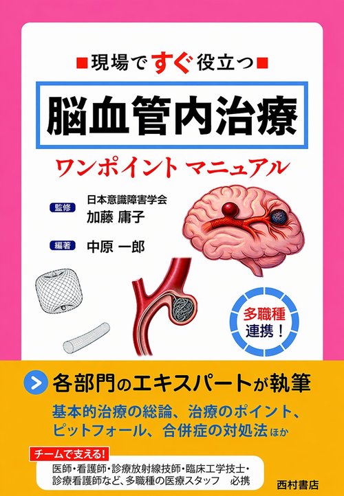 現場ですぐ役立つ 脳血管内治療ワンポイントマニュアル