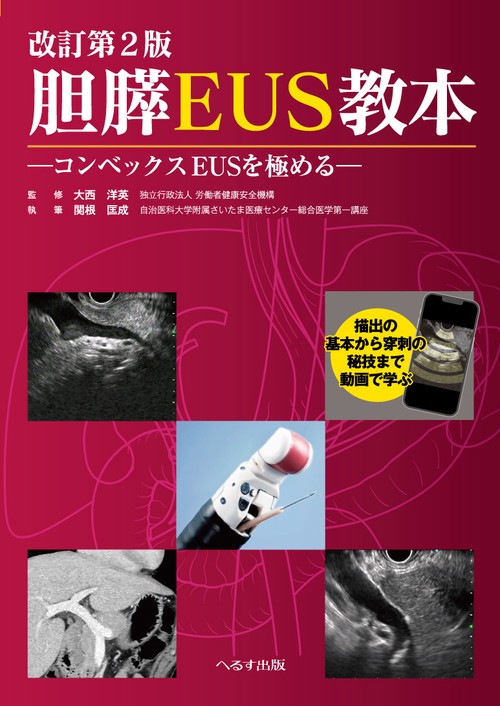 改訂第2版 胆膵EUS教本　
