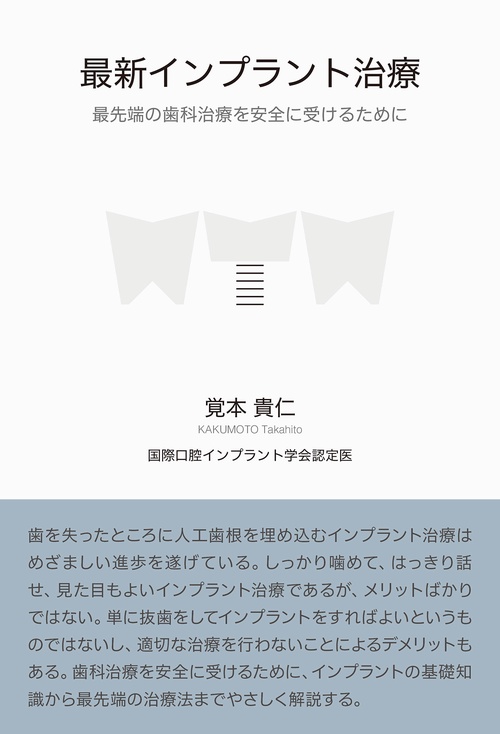 最新インプラント治療　最先端の歯科治療を安全に受けるために