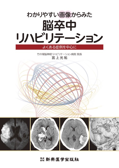 わかりやすい画像からみた脳卒中リハビリテーション