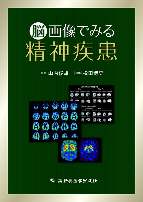 脳画像でみる精神疾患