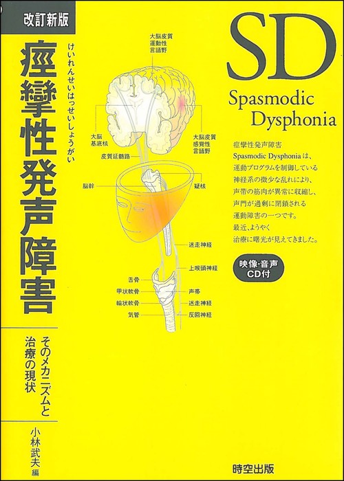 痙攣性発声障害