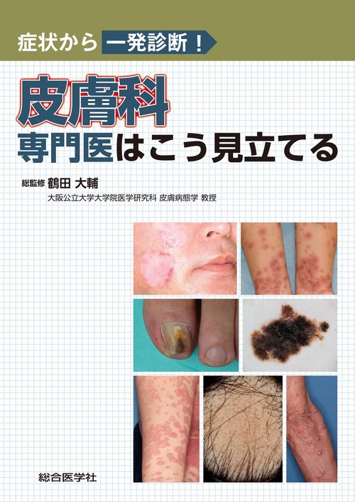 症状から一発診断！ 皮膚科専門医はこう見立てる