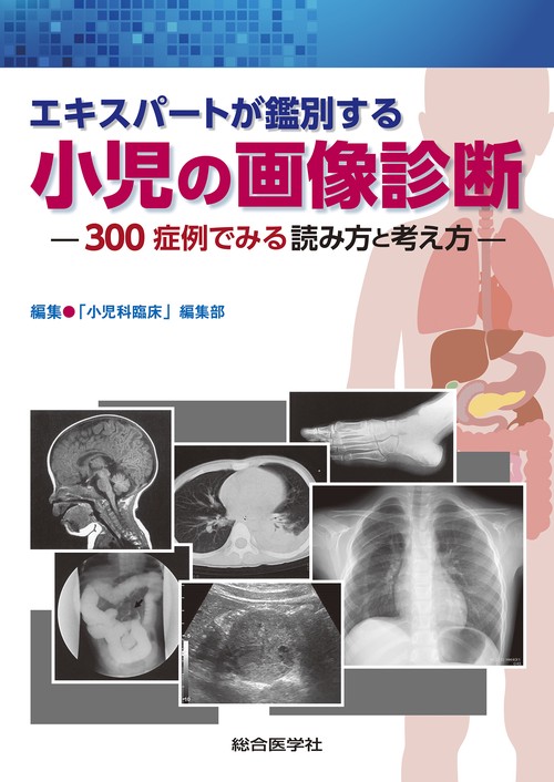 エキスパートが鑑別する 小児の画像診断