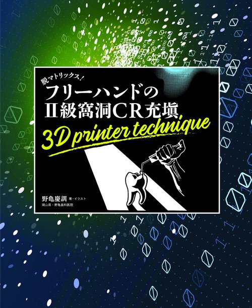 脱マトリックス！ フリーハンドのⅡ級窩洞CR充塡