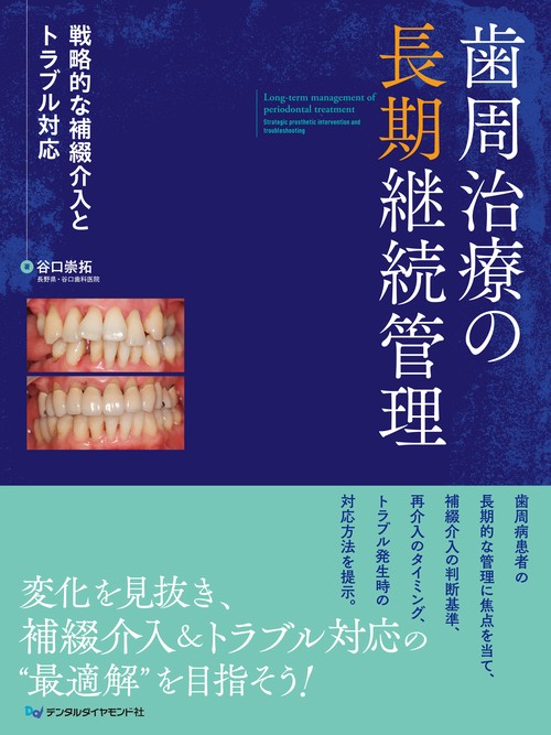 歯周治療の長期継続管理 戦略的な補綴介入とトラブル対応